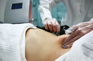 LIPOCAVITACAO O QUE E COMO FUNCIONA