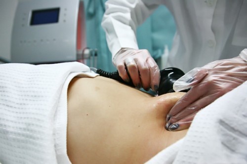 LIPOCAVITAÇÃO - O QUE É, COMO FUNCIONA, QUEM PODE FAZER?